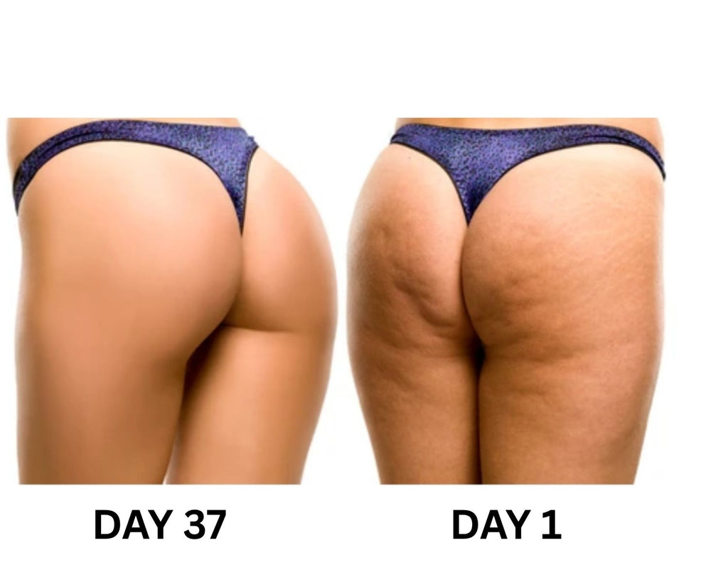 Nuivea Cellulite Relief Massager