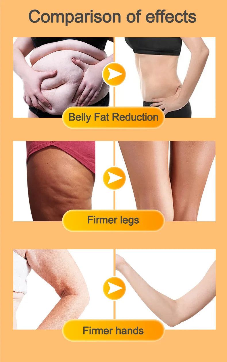 Nuivea 240ml Anti Cellulite Massage Oil Infused with Collagen and Stem Cell Skin Tightening